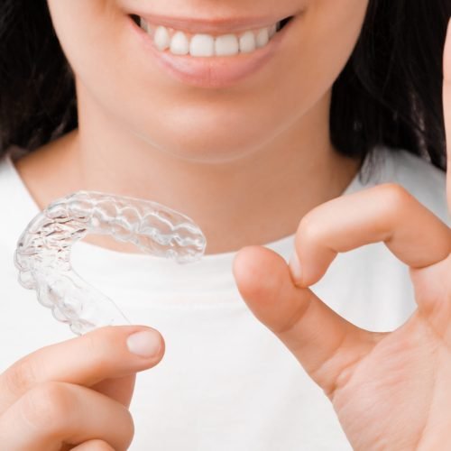 Woman shows sign ok and holding in the hand invisible aligner. Girl with a white smile using invisible whitening tray.